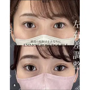 EMMO FACE CLINIC 大宮院 廣松 直樹医師の症例