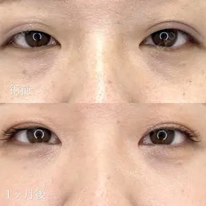 ルラ美容クリニック 札幌院 佐藤 雄紀医師の症例