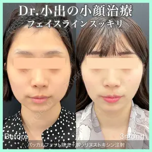 東京シンデレラ美容外科 池袋院の症例