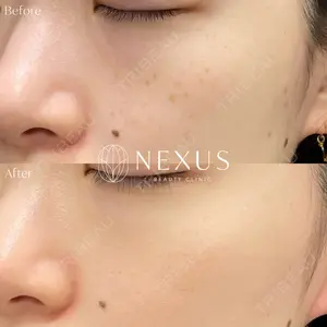 NEXUS CLINIC 酒井　知子医師の症例