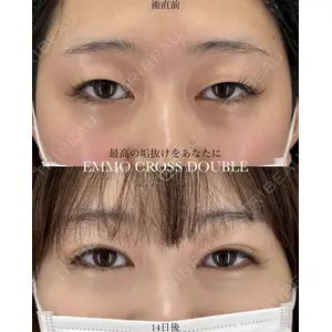 EMMO FACE CLINIC 大宮院 廣松 直樹医師の症例