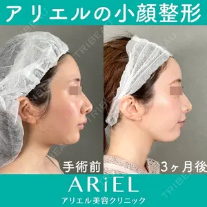 アリエル美容クリニック 大宮院 鈴木　桂介医師の症例