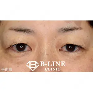 B-LINE CLINIC 池袋院 小池 康弘医師の症例