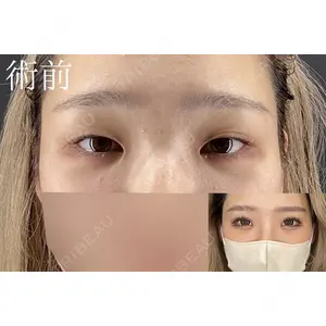 HAAB×DREAM BEAUTY CLINIC 大阪梅田院 柏木 太雅医師の症例