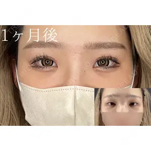 HAAB×DREAM BEAUTY CLINIC 大阪梅田院 柏木 太雅医師の症例