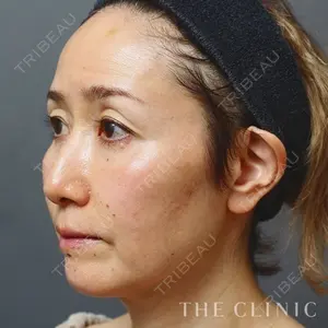 THE CLINIC（ザ・クリニック）東京院 加藤 敏次医師の症例