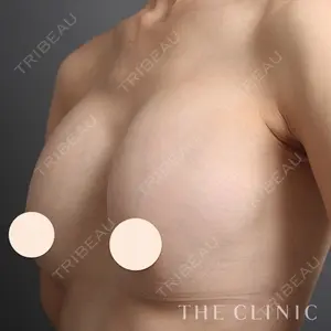 THE CLINIC（ザ・クリニック） 東京院 志田 雅明医師の症例