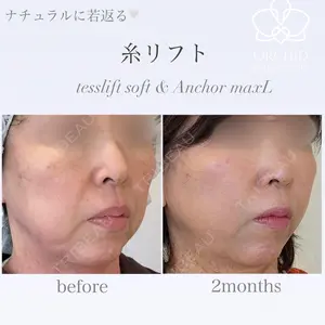 オーキッド美容クリニック東京御徒町 西浦 蘭子医師の症例