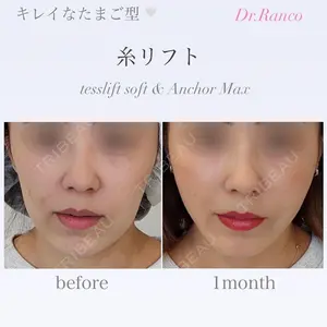 オーキッド美容クリニック東京御徒町 西浦 蘭子医師の症例