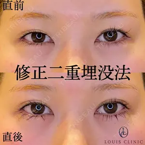 LOUIS CLINIC 二子玉川院【ルイクリニック】 小松 塁医師の症例