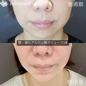 Bellefeel Clinic 代官山 兵藤 秀忠 医師の症例