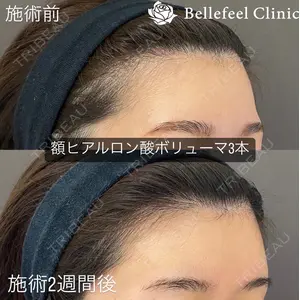 Bellefeel Clinic 代官山 兵藤 秀忠 医師の症例