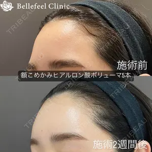 Bellefeel Clinic 代官山 兵藤 秀忠 医師の症例