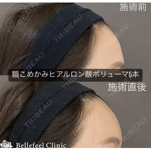 Bellefeel Clinic 代官山 兵藤 秀忠 医師の症例