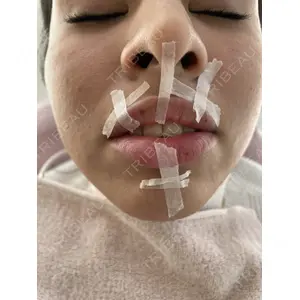 麻布十番クレールデンタルクリニック 藤田 亜樹医師の症例