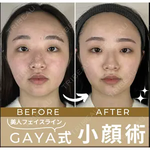 GAYA body design clinic 飯ヶ谷 重来医師の症例
