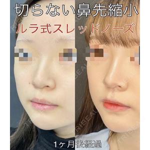 ルラ美容クリニック 渋谷本院 武内 大医師の症例