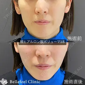 Bellefeel Clinic 代官山 兵藤 秀忠 医師の症例