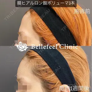 Bellefeel Clinic 代官山 兵藤 秀忠 医師の症例