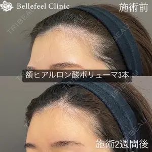 Bellefeel Clinic 代官山 兵藤 秀忠 医師の症例