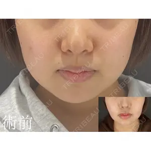 HAAB×DREAM BEAUTY CLINIC 大阪梅田院 鈴木 馨斗医師の症例