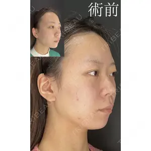 HAAB×DREAM BEAUTY CLINIC 大阪梅田院 鈴木 馨斗医師の症例