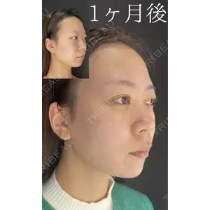 HAAB×DREAM BEAUTY CLINIC 大阪梅田院 鈴木 馨斗医師の症例