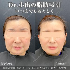 東京シンデレラ美容外科 池袋院の症例