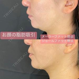 ルラ美容クリニック 新宿院 高木 欽之医師の症例