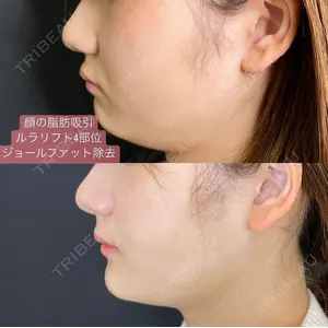 ルラ美容クリニック 新宿院 高木 欽之医師の症例