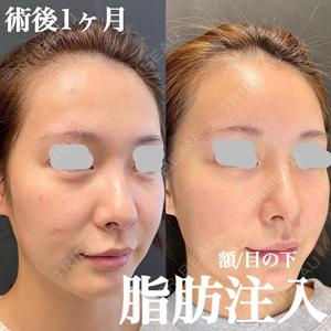 ルラ美容クリニック 仙台院 / ルラスキンクリニック 仙台院の症例