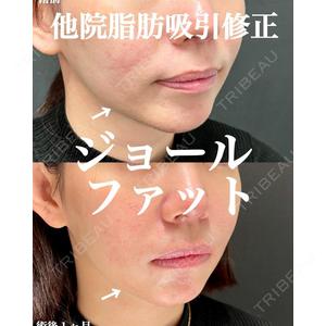 ルラ美容クリニック 渋谷本院の症例