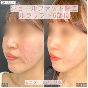 ルラ美容クリニック 大阪心斎橋院 藤川 一朗医師の症例