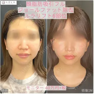 ルラ美容クリニック 大阪心斎橋院 藤川 一朗医師の症例