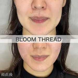 ブルームクリニック（BLOOM CLINIC） 大西 雅樹医師の症例