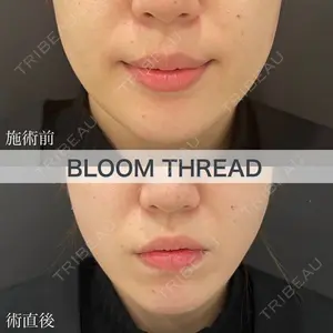 ブルームクリニック（BLOOM CLINIC） 大西 雅樹医師の症例