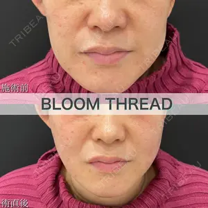 ブルームクリニック（BLOOM CLINIC） 大西 雅樹医師の症例