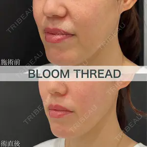 ブルームクリニック（BLOOM CLINIC） 大西 雅樹医師の症例