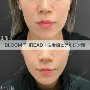 ブルームクリニック（BLOOM CLINIC） 大西 雅樹医師の症例