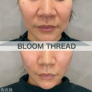 ブルームクリニック（BLOOM CLINIC） 大西 雅樹医師の症例