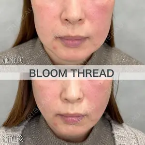 ブルームクリニック（BLOOM CLINIC） 大西 雅樹医師の症例