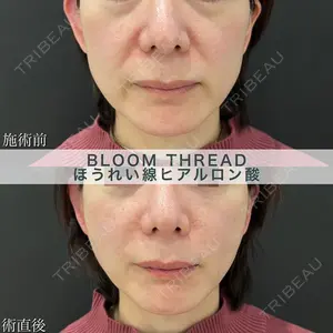 ブルームクリニック（BLOOM CLINIC） 大西 雅樹医師の症例