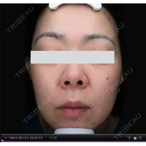エトワールレジーナクリニック 表参道院の症例