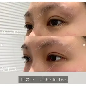 X CLINIC 恵比寿院 辻村 梢医師の症例
