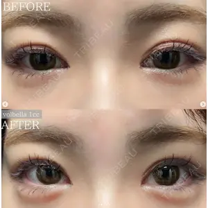 X CLINIC 恵比寿院 辻村 梢医師の症例