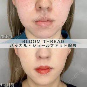 ブルームクリニック（BLOOM CLINIC） 大西 雅樹医師の症例