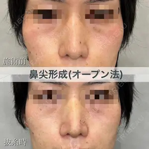 ブルームクリニック（BLOOM CLINIC） 大西 雅樹医師の症例