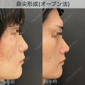 ブルームクリニック（BLOOM CLINIC） 大西 雅樹医師の症例