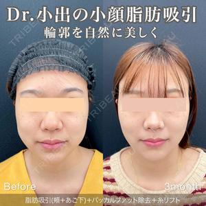 東京シンデレラ美容外科 池袋院の症例