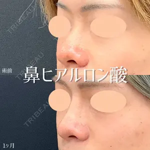 東京シンデレラ美容外科 池袋院 小出 真哉医師の症例